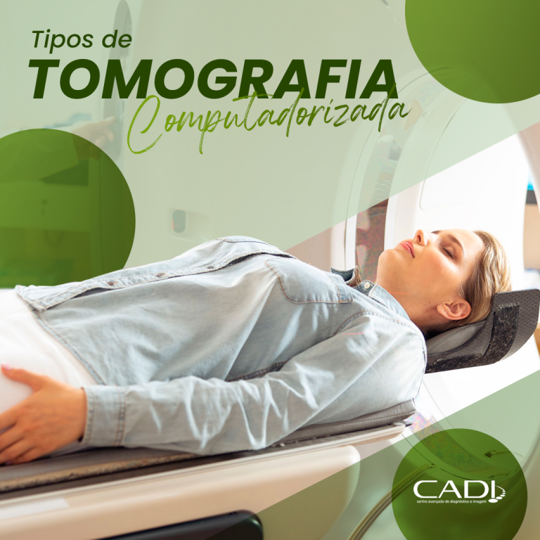 Tipos de Tomografia Computadorizada