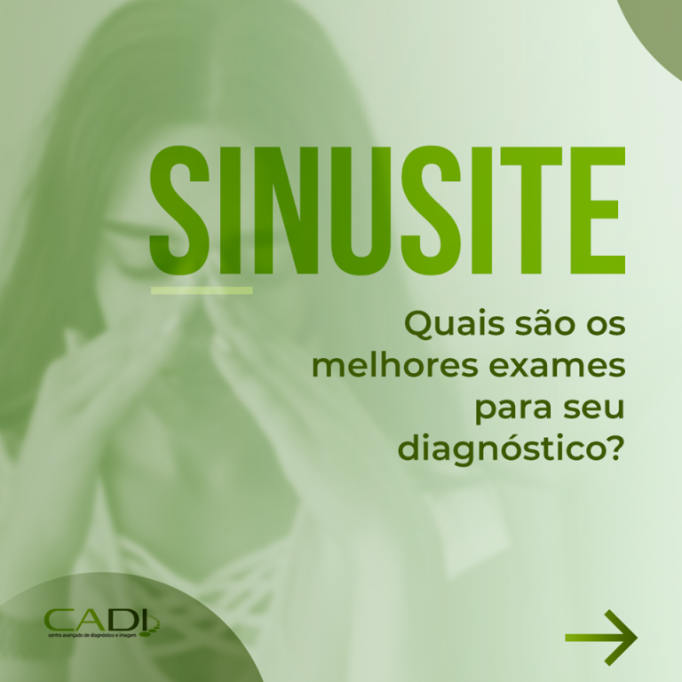 O que é Sinusite?