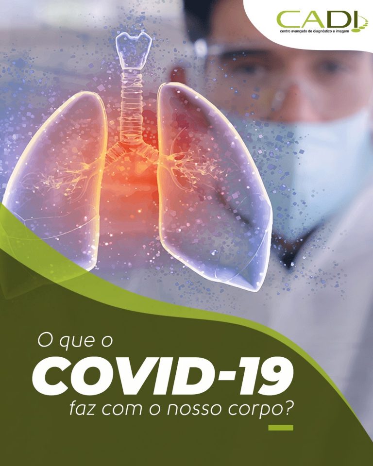 Covid 19